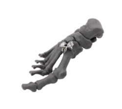 psi patient specific instruments